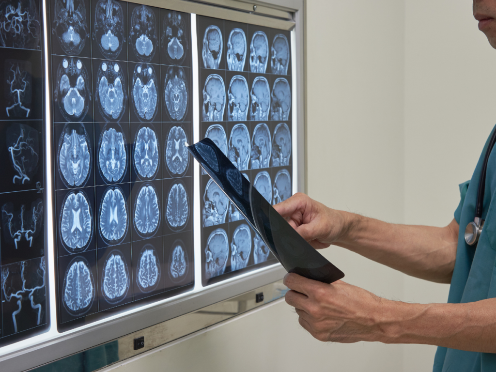 Could psychedelics harness neuroplasticity to treat addiction and other mental illness?